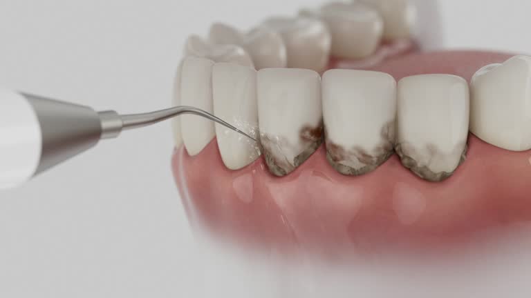 Reliable Dental Crowns And Bridges contractor in Rapides Parish County, LA by Dentist Open Now